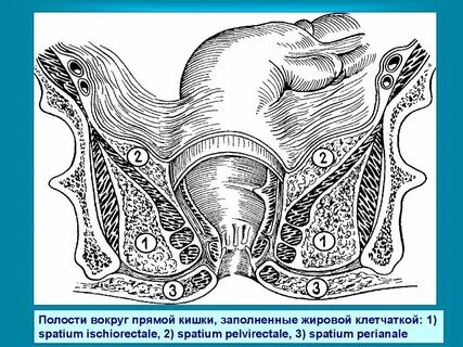 Инфекции прямой кишки