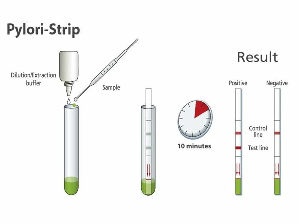 Уреазный тест что значит. Быстрый уреазный тест хелпил-тест. Уреазный тест на хеликобактер. 13с-уреазный дыхательный тест. Эндоскопический уреазный экспресс-тест на Helicobacter pylori.