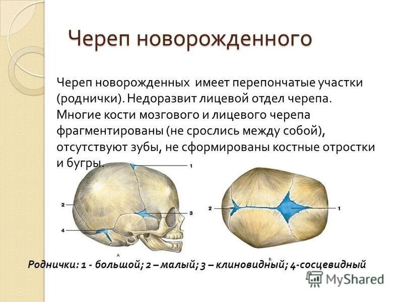 Соединение костей черепа роднички. Кости черепа новорожденного роднички. Расположение родничков черепа у новорожденного. Роднички у новорожденных анатомия.