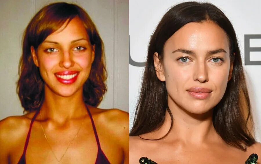 Did Irina Shayk Have Plastic Surgery? (Before & After 2021)