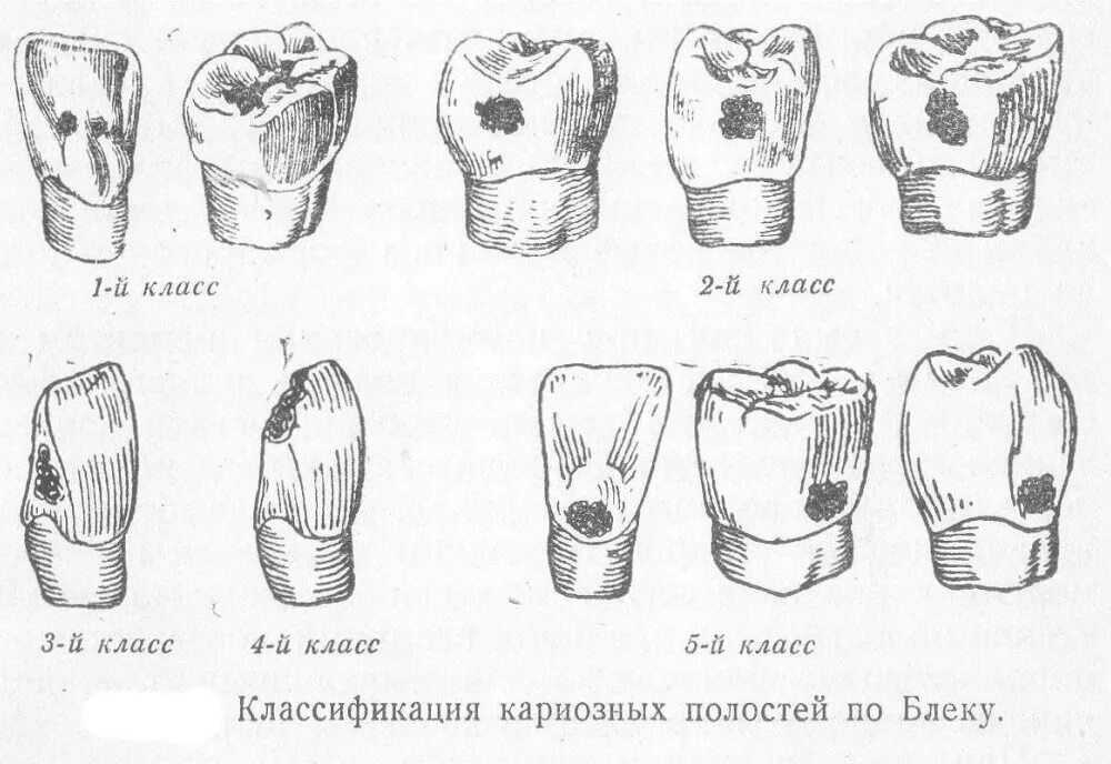 Классификация поражений зубов