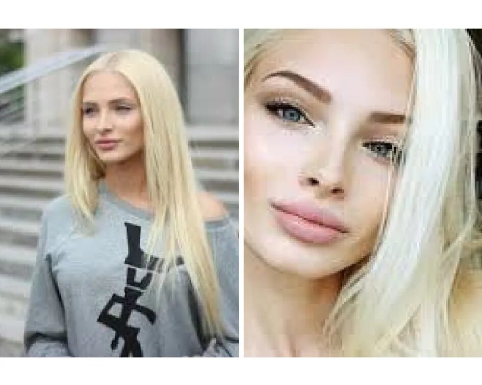 Шишкова сейчас. Шишкова без фотошопа. Фотошоп шишковой. Фотошоп шишковой. Фотошоп шишковой.