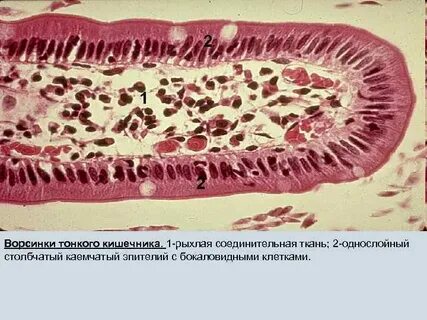 Зарисуйте клетки эпителия кишечника подпишите детали
