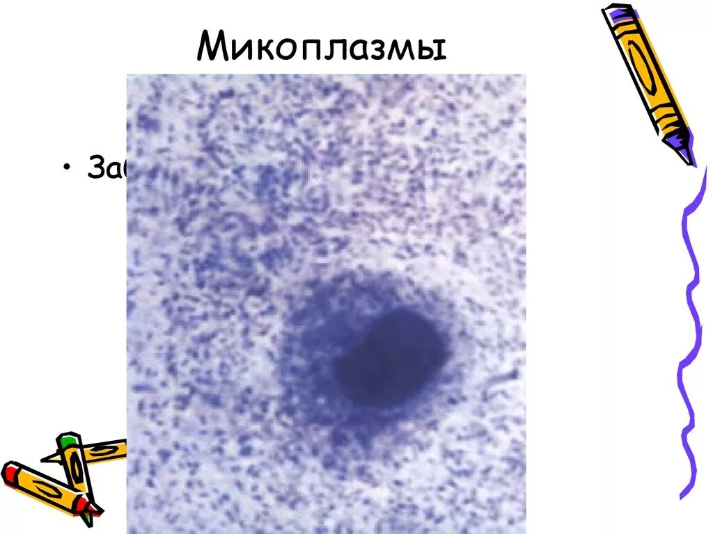 Пролин у микоплазм. Микоплазмы микробиология морфология. микоплазмы препарат микробиология. микоплазмы строение микробиология. микоплазмы рисунок.