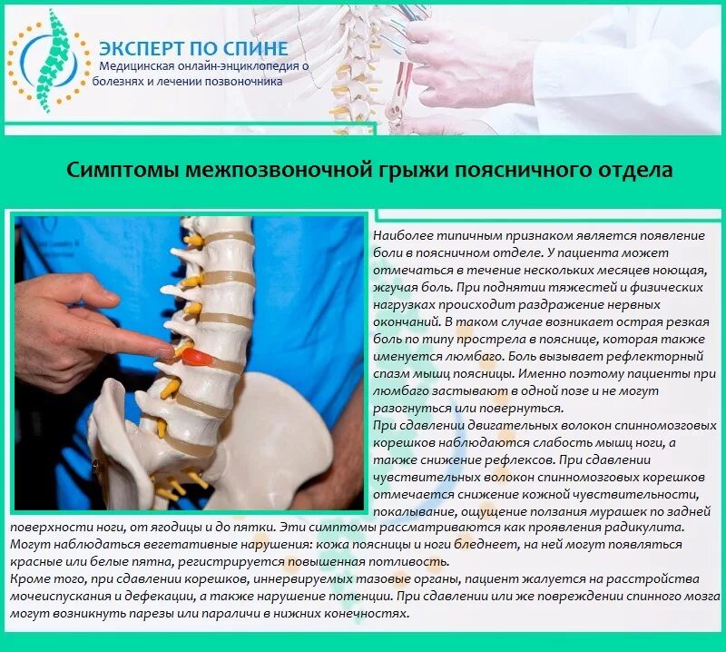 Как уменьшить поясничную грыжу