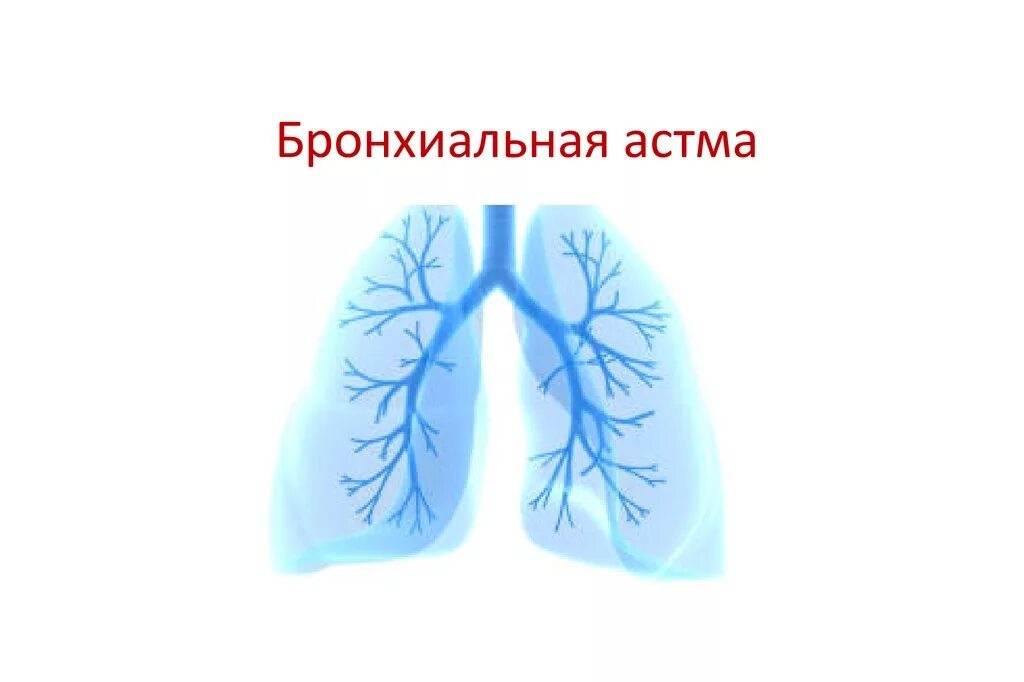 Bronchial asthma. Бронхиальная астма. Бронхиальная астма бронхи. Бронхиальная астма картинки. Бронх астма.