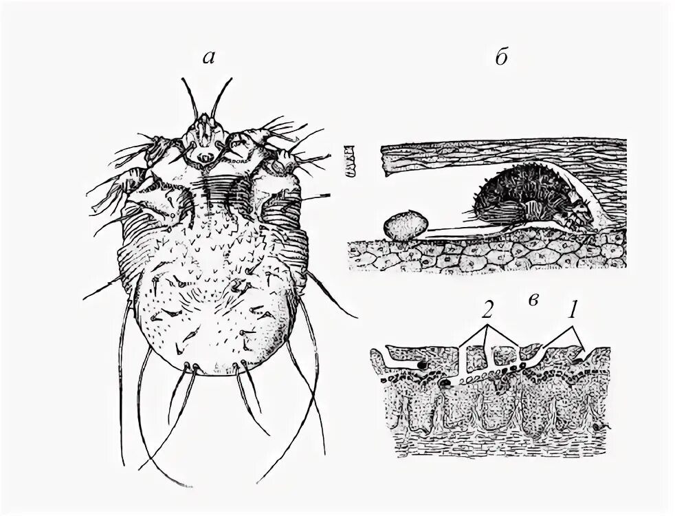 Чесоточный клещ Sarcoptes scabiei. Жизненный цикл чесоточный клещ Sarcoptes scabie. Sarcoptes scabiei цикл развития. Чесоточный зудень жизненный цикл.