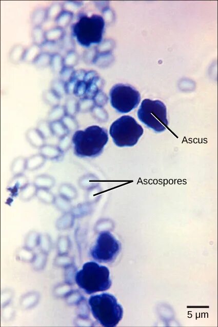 Pneumocystis jirovecii микробиология. Возбудитель пневмоцистоза - pneumocystis carinii. Fungi днк в мазке что. Fungal slides hyphae. Хитридиомицеты.