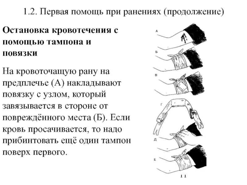 Кровотечение из раны мкб. Оказание первой медицинской помощи при ранениях. правила оказания первой помощи пострадавшему при ранениях. последовательность оказания первой неотложной помощи при ранениях. последовательность оказания первой помощи при обработке раны.