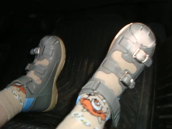 Приведение стопы у ребенка. Приведение переднего отдела стопы. Переведение переднего отдела стопа. Варусное приведение переднего отдела стопы. Приведение переднего отдела стопы.