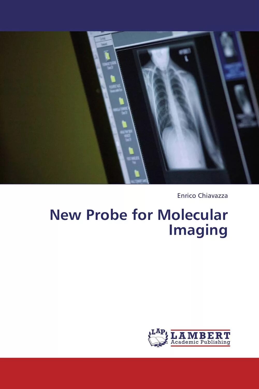 Molecular imaging. Molecular imaging