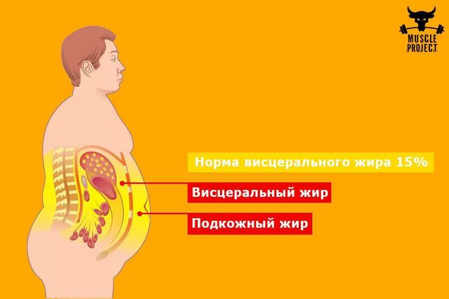 Сколько человек в животе. Подкожный и висцеральный жир. Подкожный, висцеральный жир на животе. Ожирение внутренних органов.