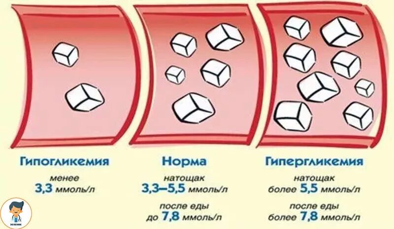 Какие признаки сахара в крови. Показатели сахара при гипогликемии. Сахарный диабет у детей уровень сахара в крови. Показатели Глюкозы в крови при гипогликемической. Гипергликемическая кома уровень сахара.