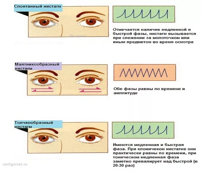 Непроизвольное движение глазных яблок
