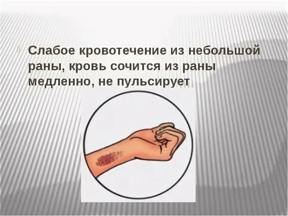 Песня почему залечит раны