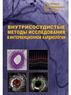 Интервенционная кардиология