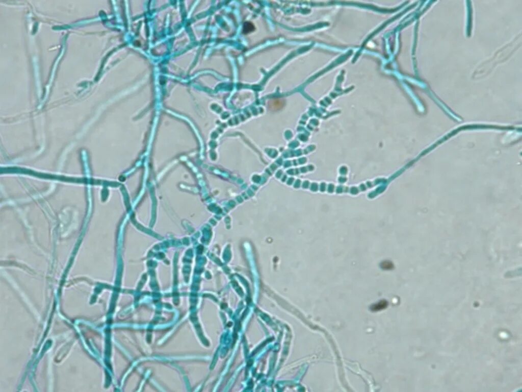 грибок микроскопия. микроскопия trichophyton rubrum. микроскопия trichophyton rubrum. онихомикоз микроскопия. грибок микроскопия.