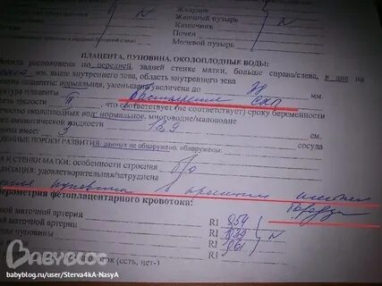 Пуповина 3 сосуда