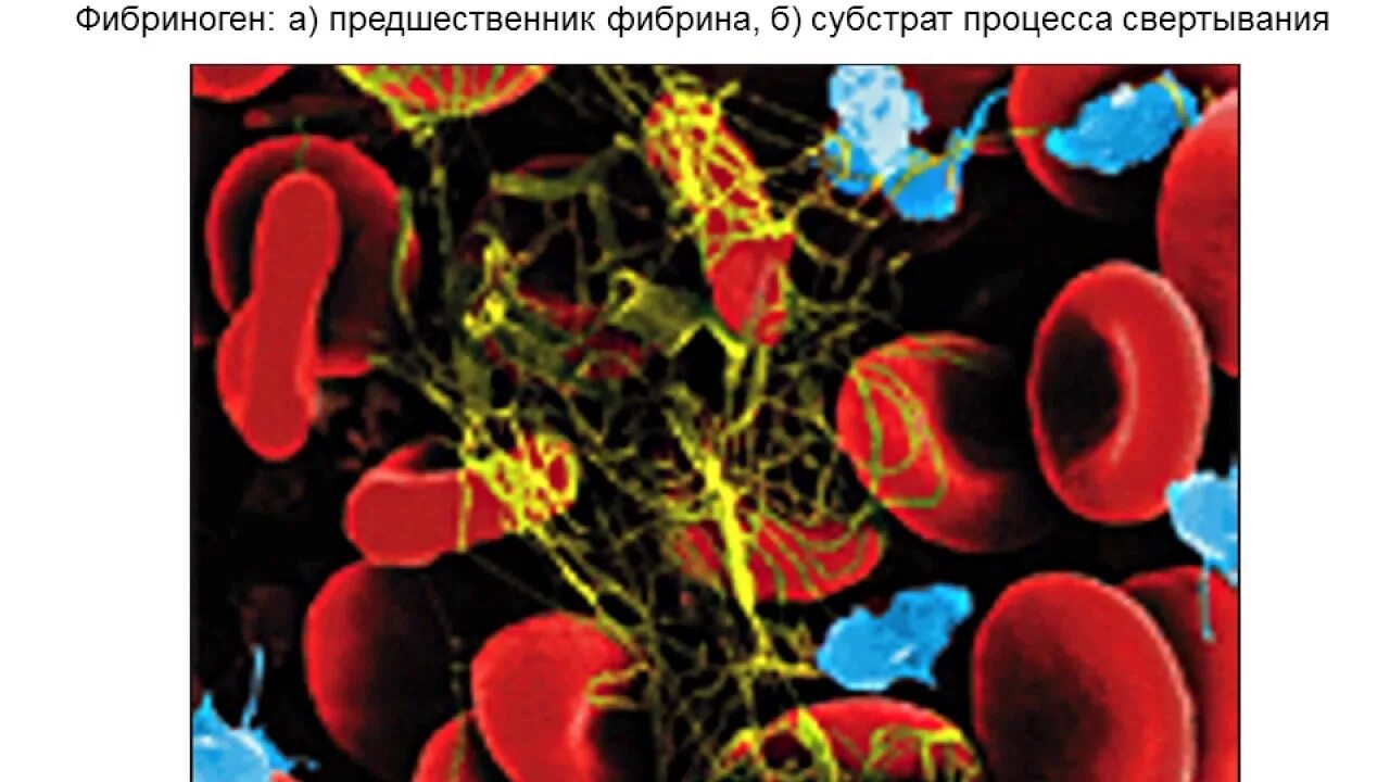 Фибриноген гемоглобин. Фибриноген гемоглобин