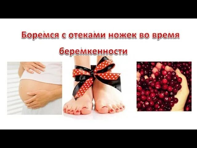 Отеки при беременности в третьем. Отёки ног при беременности. от отеков для беременных 3 триместр. отёки ног при беременности в 3 триместре.
