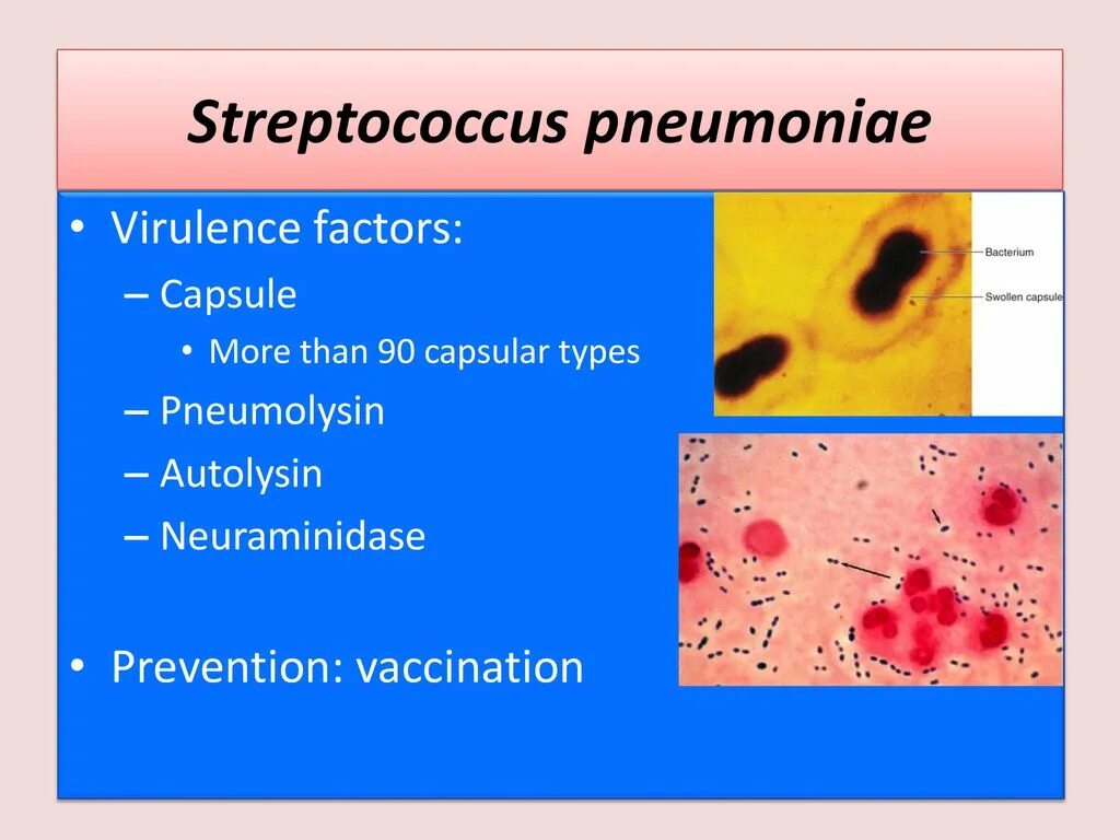 Streptococcus pneumoniae haemophilus influenzae streptococcus. Str pneumoniae микробиология. streptococcus pneumoniae (пневмококк). streptococcus pneumoniae механизм передачи. пневмококк или streptococcus pneumoniae.