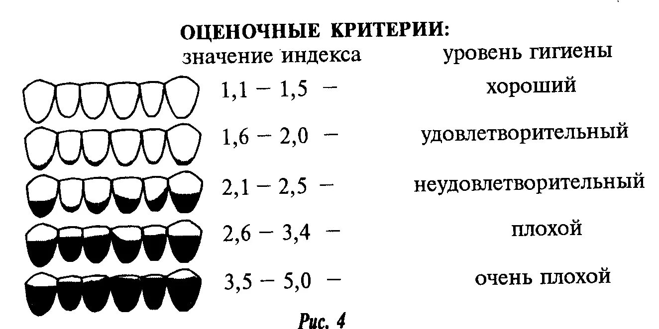 Гигиенические индексы полости. Федорова-Володкиной в стоматологии. Индекс гигиены полости рта Федорова-Володкиной. Индекс гигиены Федорова Володкиной. Методика определения зубного налета по Федорову Володкиной.