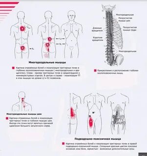 Триггерные точки книга