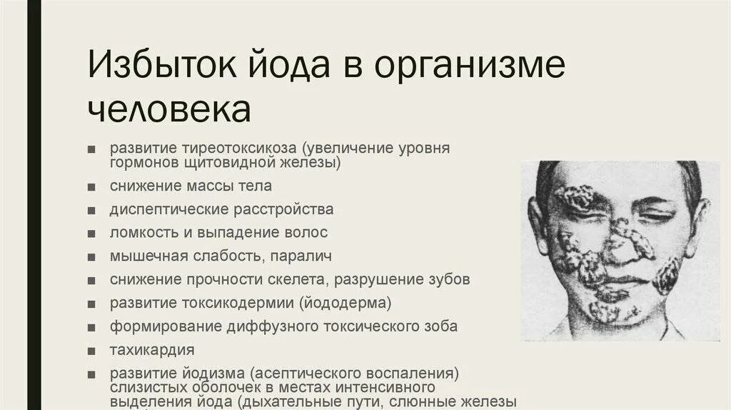 Передозировка железом симптомы. При избытке йода в организме симптомы у женщин. Заболевания при избытке йода в организме. Переизбыток йода в организме щитовидка. Профицит йода в организме симптомы.