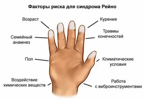 Почему болят пальцы на руках и ногах