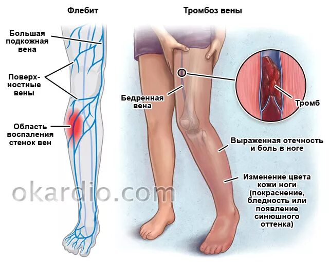 Ноги выше колена