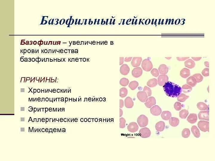Эозинофильный лейкоцитоз механизм. Патология крови лейкоцитозы. Механизм развития эозинофильного лейкоцитоза. Эозинофильный лейкоцитоз механизмы развития. Что значит лейкоцитоз