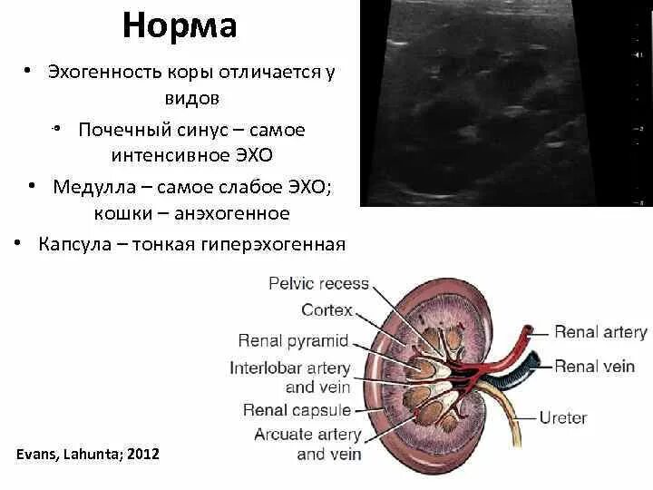 Паренхима почки что это. Верхний сегмент синуса почки. Структура почечного синуса нормы. Строение паренхимы почек. Паренхима почек на УЗИ норма.