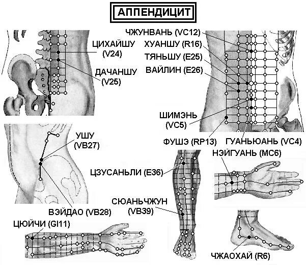 Точки аппендицита. Акупунктурные точки для повышения потенции у женщин. Акупунктура точки при цистите. Акупунктурные точки для эрекции. Активные точки для потенции.