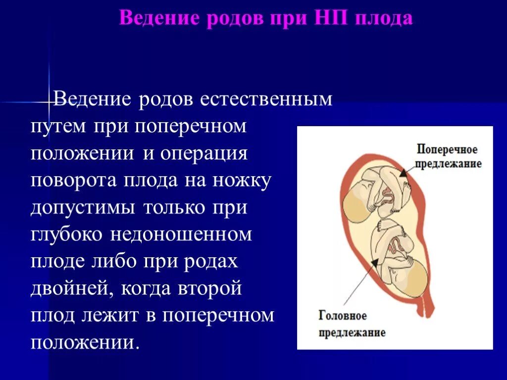 Роды положение плода