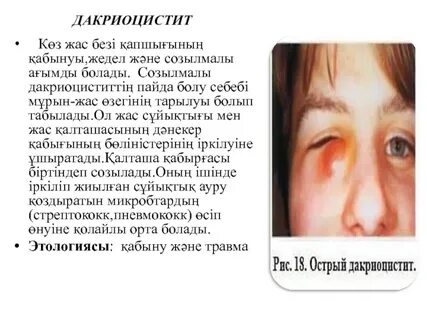 Уфадағы секс кештері