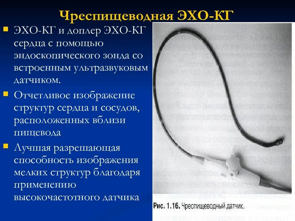 Эхо ошибок. Чреспищеводная эхокардиография. Датчик для чреспищеводной эхокардиографии. Чреспищеводное исследование сердца. Датчик для ЧПЭХОКГ.