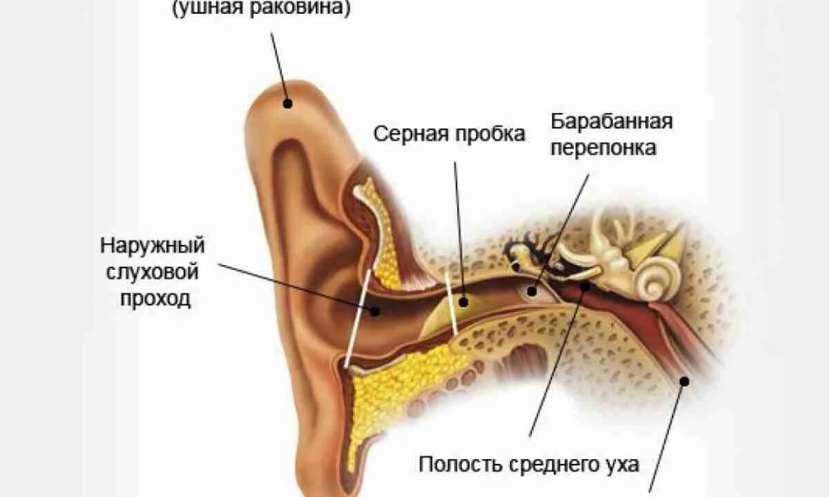 Заложило ухо сильно болит что делать. Заложенность в ухе и шум. Образование на ушной раковине.