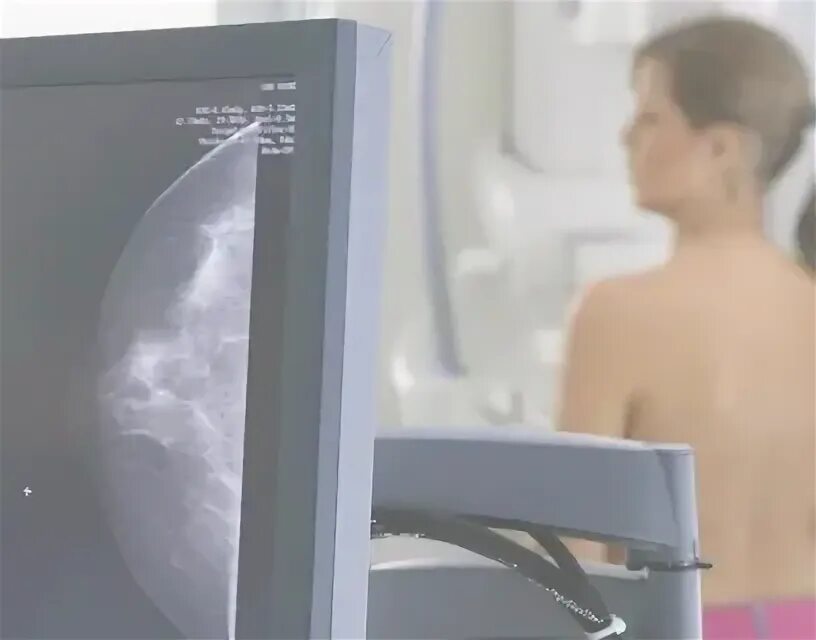 Маммография обязательно. Маммография Hologic Selenia. Малоинформативная маммография.