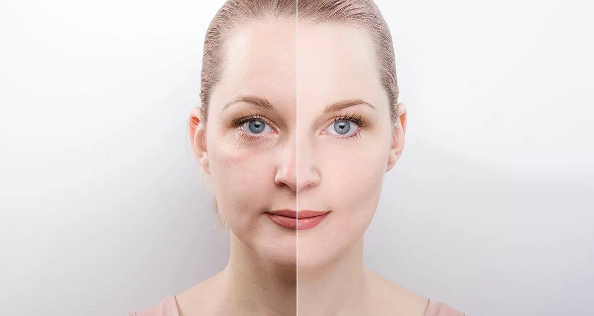 Remove effect