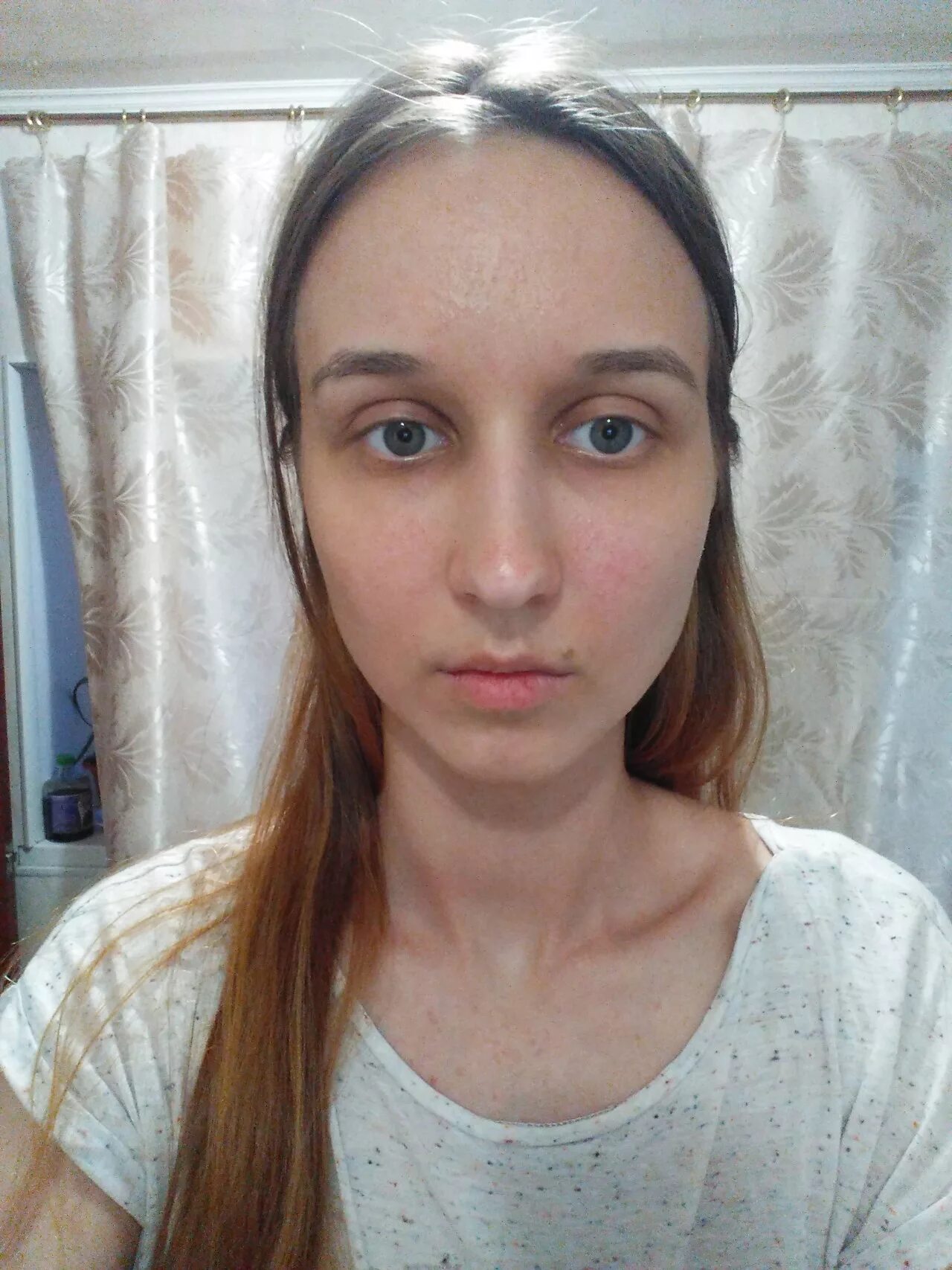 Как выглядят синяки под глазами Что вызывает появление синяков под глазами Современная девушка