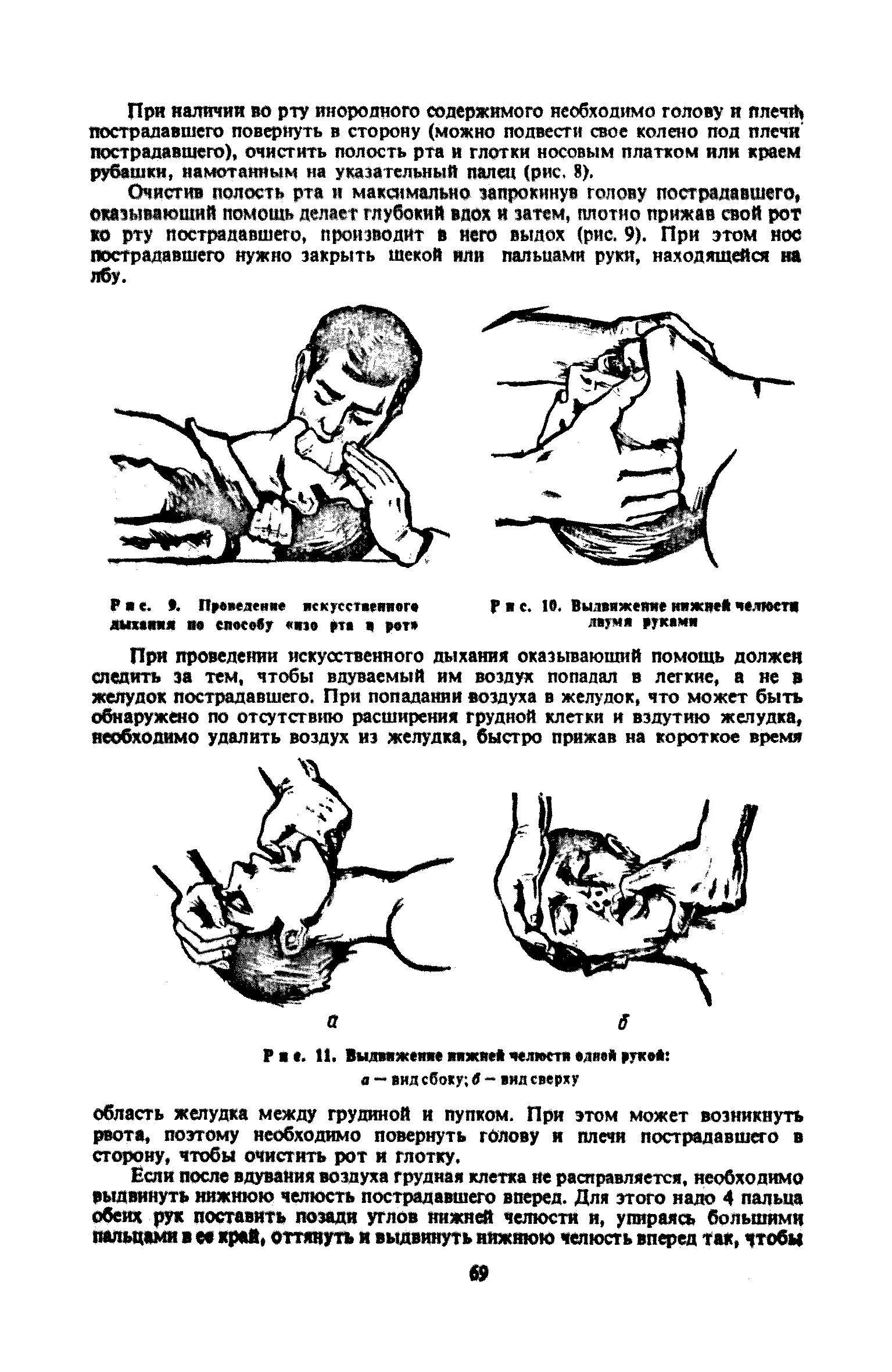 Для удаления воздуха из желудка необходимо. Искусственное дыхание для удаления воздуха из желудка необходимо. Удаление воздуха из желудка при искусственном дыхании. При искусственном дыхании для удаления воздуха из желудка необходимо. Как удалить воздух из желудка для искусственного дыхания.