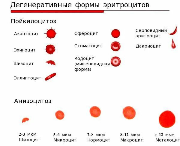 Уровень гемоглобина при железодефицитной анемии. Изменение формы эритроцитов при анемии. Патологические формы эритроцитов при различных анемиях. Изменение эритроцитов при железодефицитной анемии. Размер эритроцитов при железодефицитной анемии.