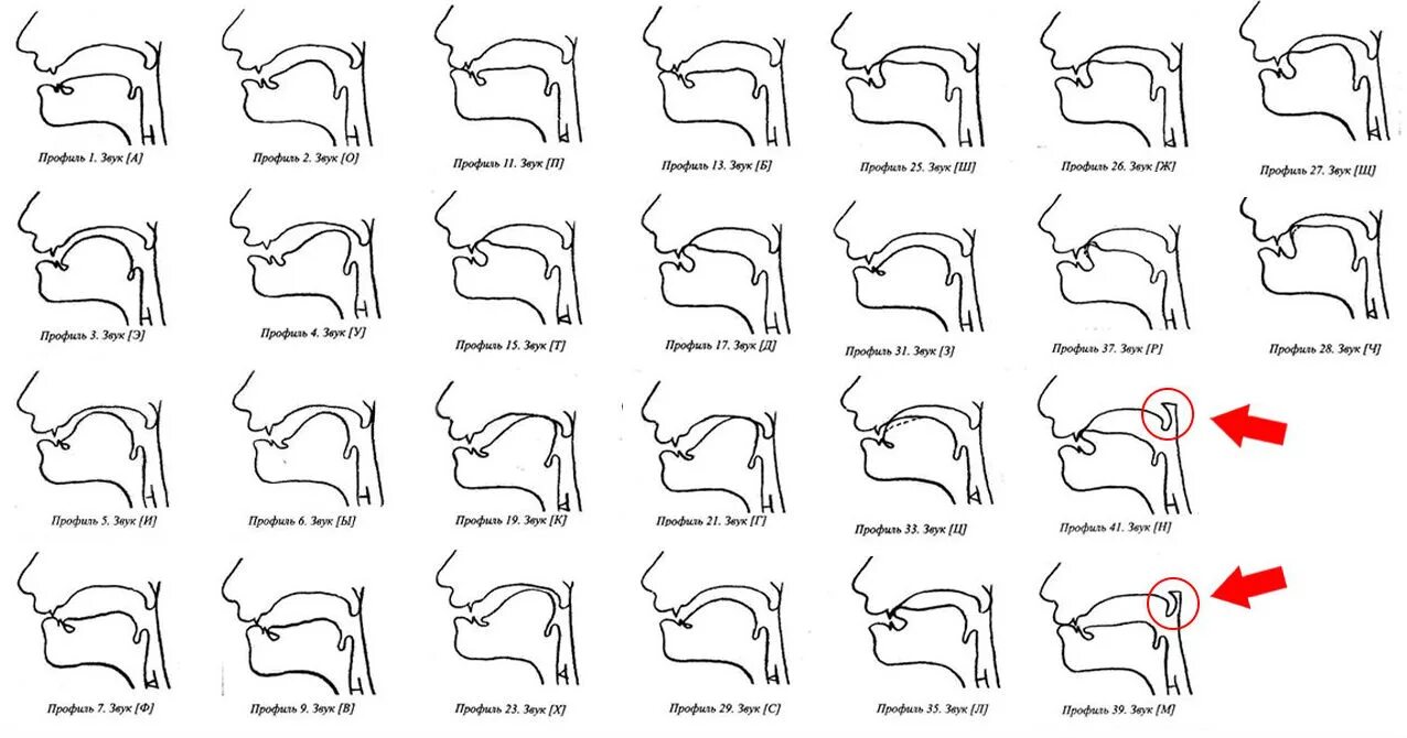 Профили артикуляции звуков. Артикуляционные профили гласных звуков при ринолалии. Артикуляционный профиль звука с схема. Положение языка при произношении английских звуков. Профиль артикуляции