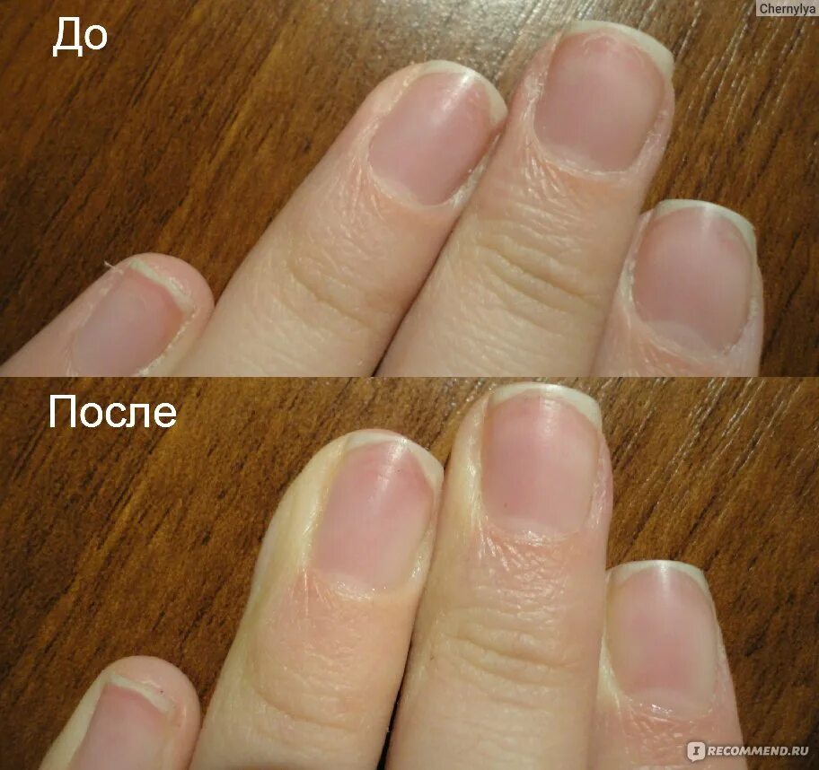 Ногти после снятия гель лака. После снятия шеллака. Испорченные ногти после шеллака. Маникюр до и после. Ногти до и после маникюра гель лаком.