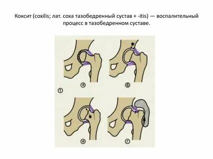 Коксит
