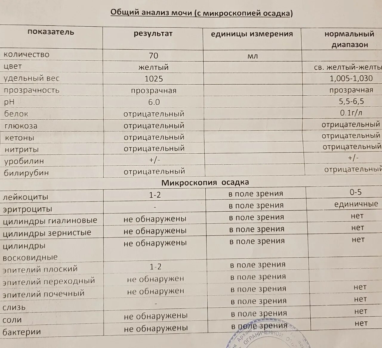 Простата какие анализы сдавать