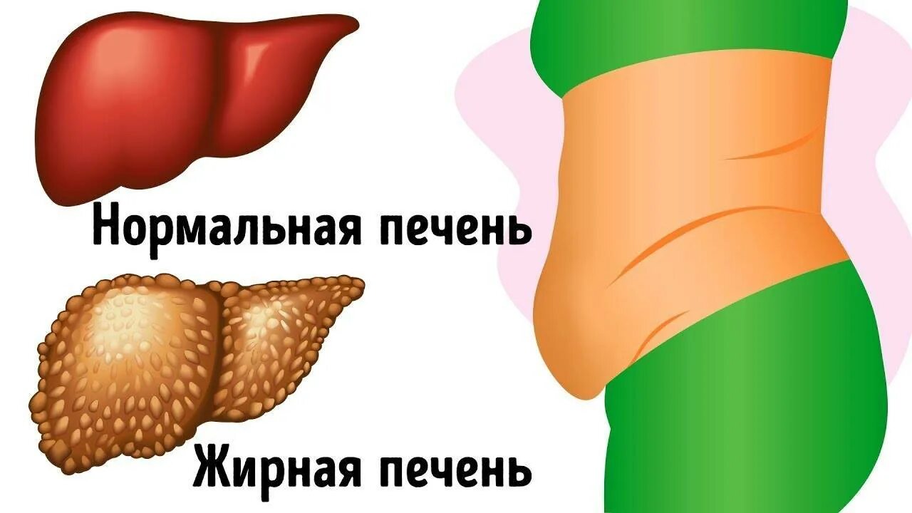 Убрать жировую печень