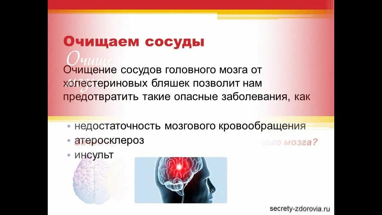 Улучшение мозгового кровоснабжения. Сосудисто вегетативная дистония головного мозга. Расширение сосудов головного мозга. Сосуды головного мозга лелюк. Упражнения для сосудов головного мозга и шеи.