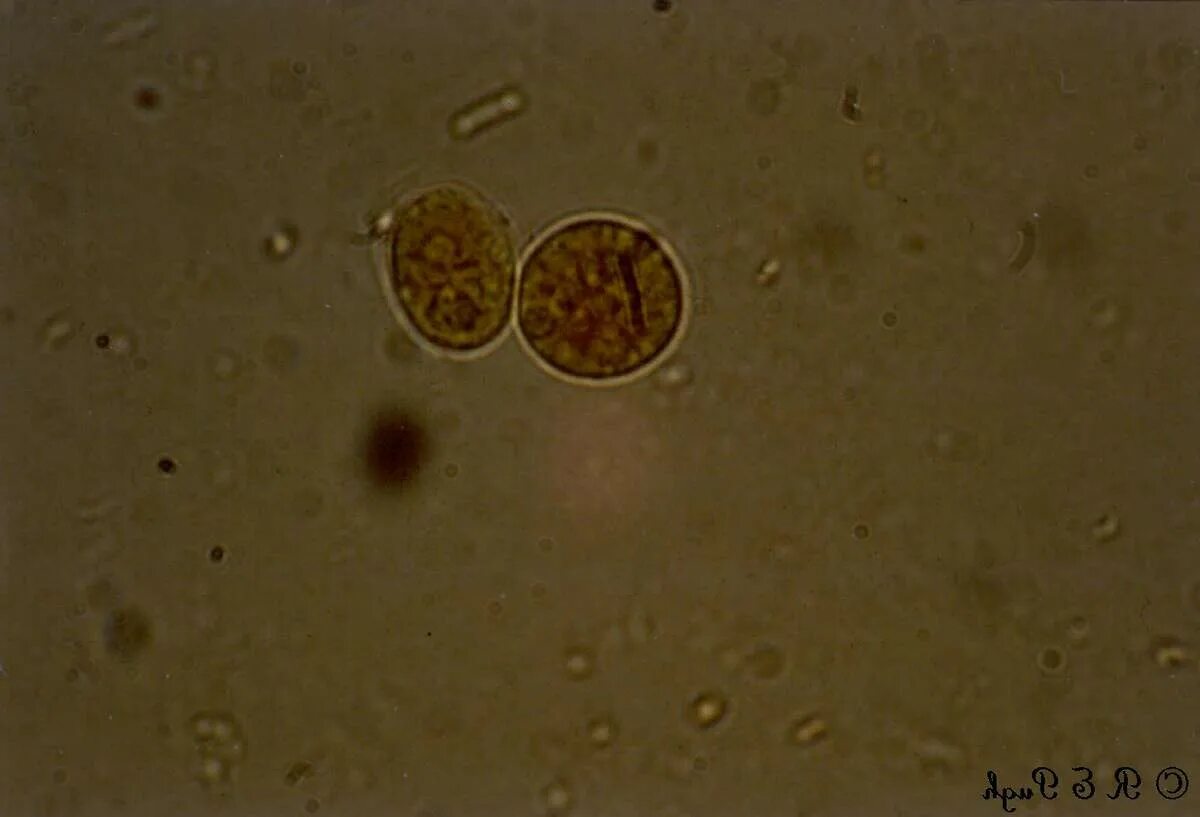 Entamoeba coli в кале. Цисты Entamoeba. Дизентерийная амеба в Кале. Цисты микроскопия.