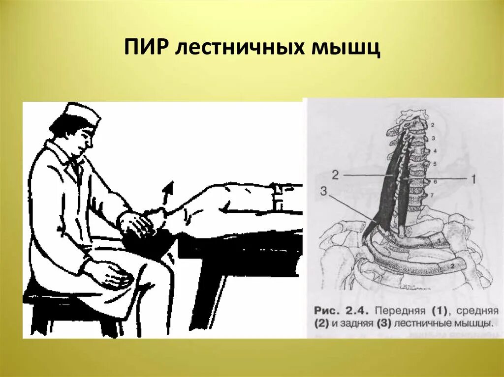 Положение пир. Лестничные мышцы. лестничные мышцы шеи. пир лестничных мышц. постизометрическая релаксация передней лестничной мышцы.